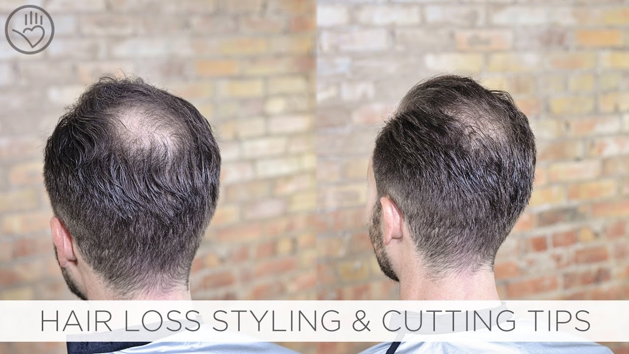 How To Cut &amp;amp; Style Balding Or Thinning Hair - Youtube with Haircuts For Thinning Hair At Crown
