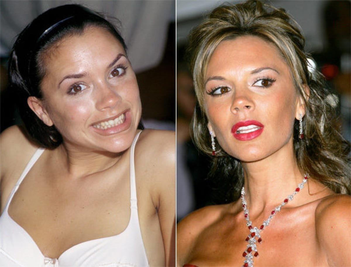 Bad Teeth Makeover Games for Celebrity Before And After Makeup Games