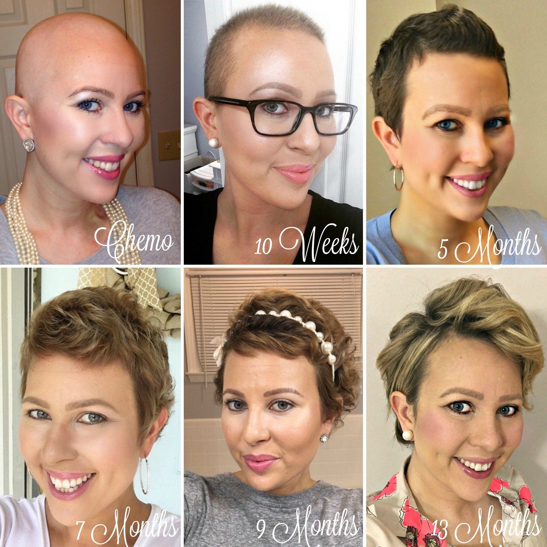 Chemo Regrowth: How To Style Your Short Hair | After Chemo throughout Hairstyles For Cancer Survivors