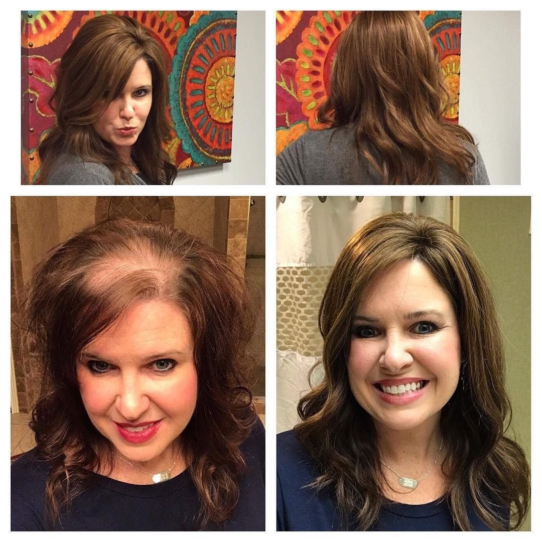 Hair Toppers For Women With Thinning Hair Or Hair Loss! How within Women Balding Hair Style