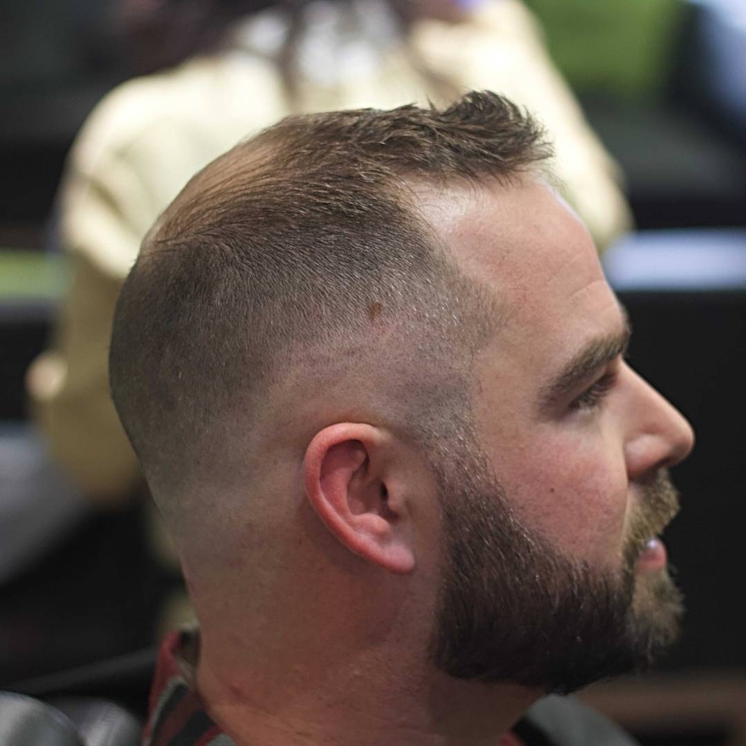 Haircuts For Balding Men inside Styles For Bald Spot