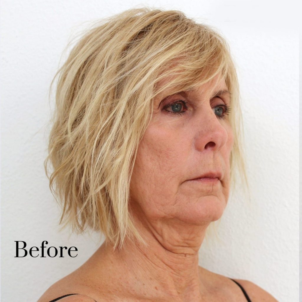 Best Haircut For Sagging Jawline Archives Wavy Haircut   Instant Neck Lift Within Best Hairstyles For Sagging Jowls 1024x1024 