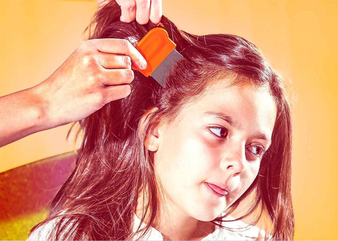 Lice Treatment For Kids: Don't Panic, Make Sure It's in Cut Hair After Lice