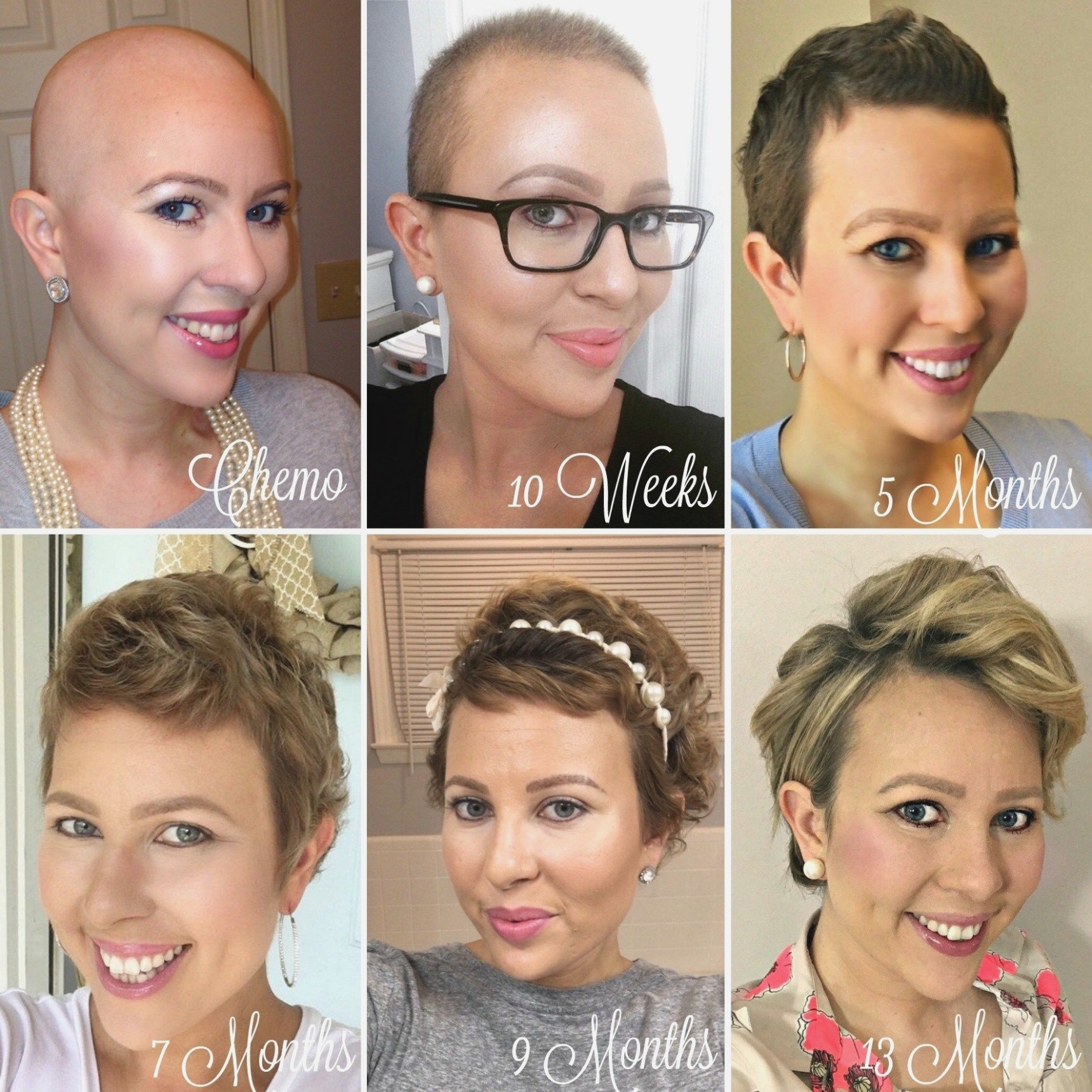 Reasons Why Short Haircuts For Cancer | The Hairstyles Ideas for Haircut For Cancer Patients